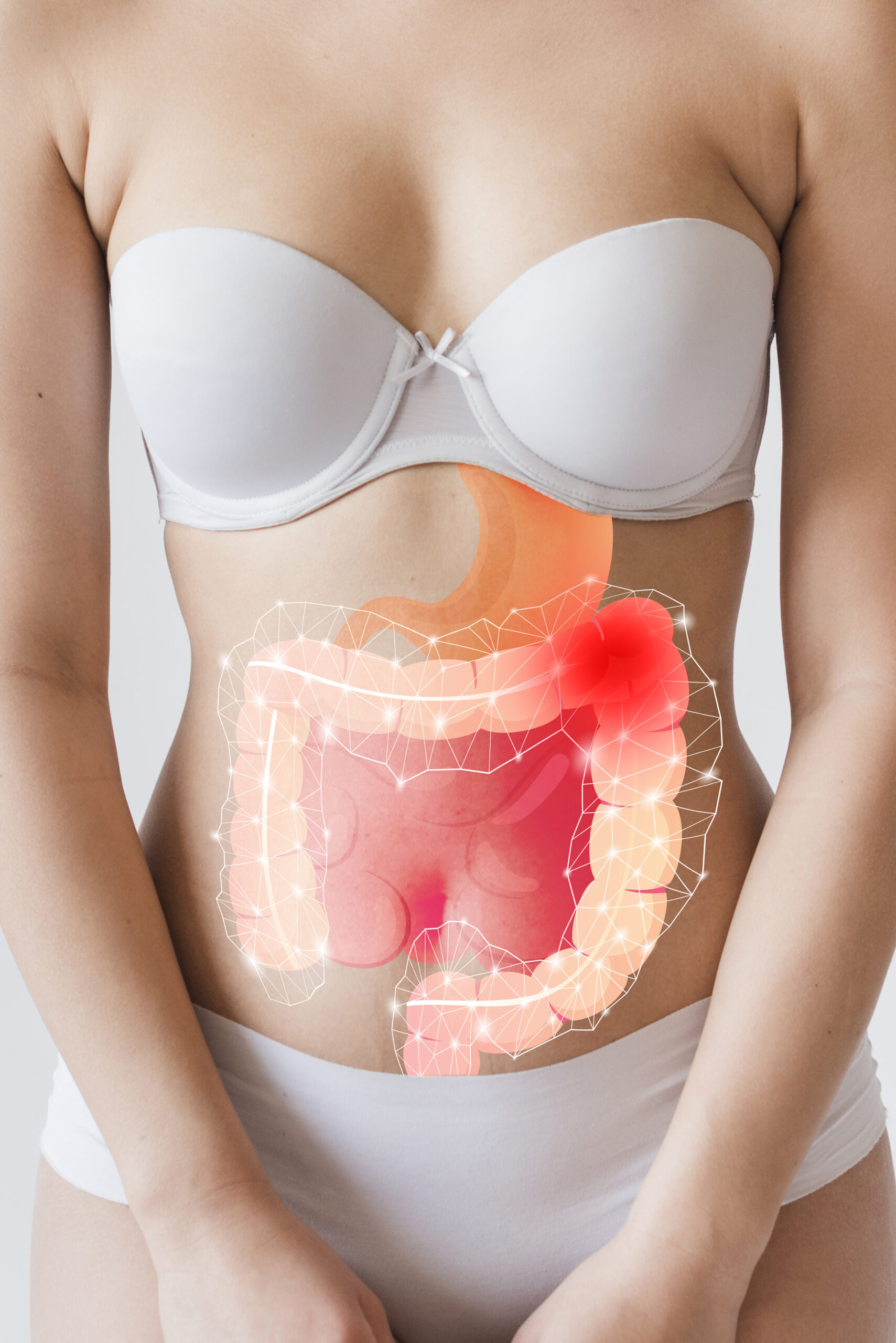 Magenbypass in der Türkei | Cayra Clinic | Antalya & Istanbul