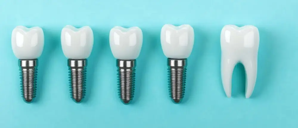 All-on-4-Zahnimplantate.