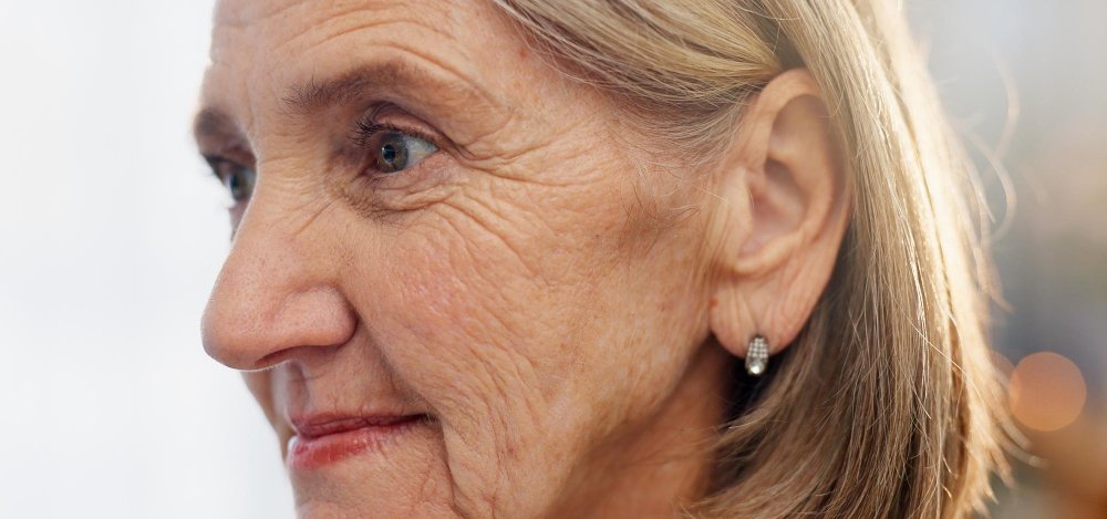 Fetttransfer ins Gesicht