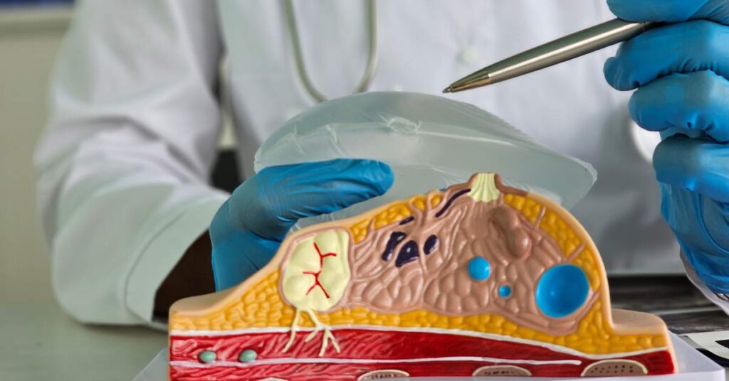 Die-Wahl-des-richtigen