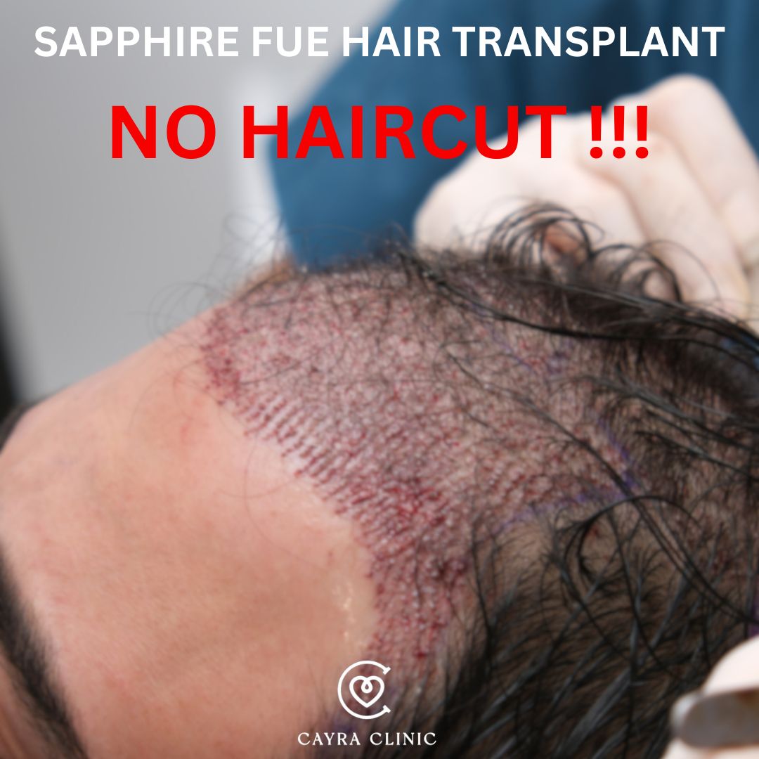 Sapphire Fue Haartransplantation