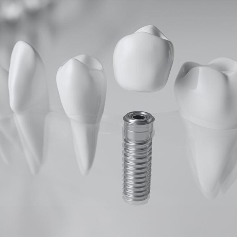 Zahnimplantat-Materialien 2026 – Titan vs. Keramik