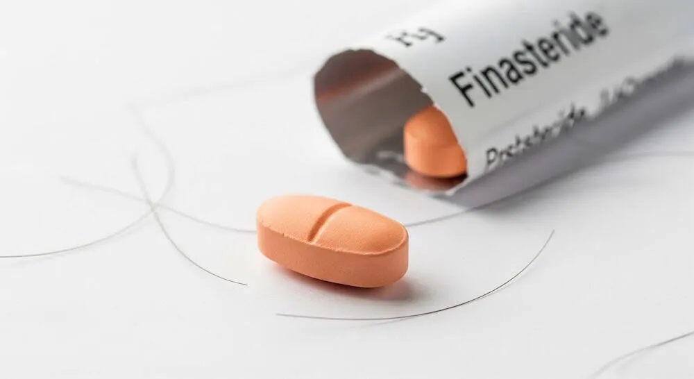 Finasterid vs. Minoxidil