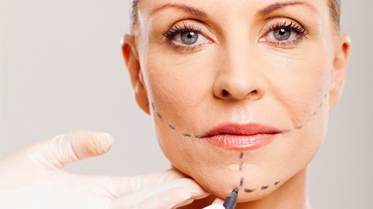 Genioplastik in der Türkei