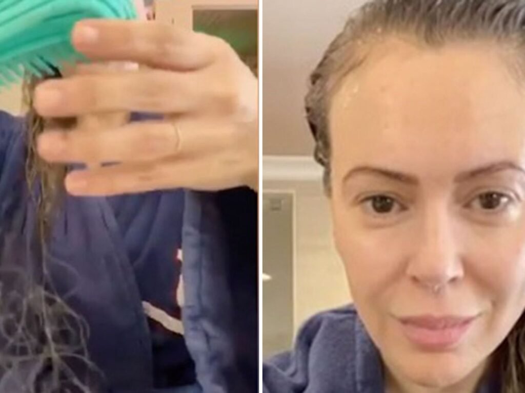 Haarausfall nach COVID-19