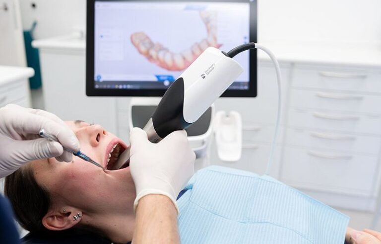 Digitaler Zahnabdruck statt Gips