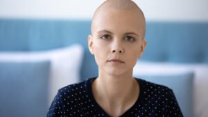 Haarausfall durch Chemotherapie