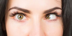 Schielkorrektur (Strabismus) bei Erwachsenen in der Türkei