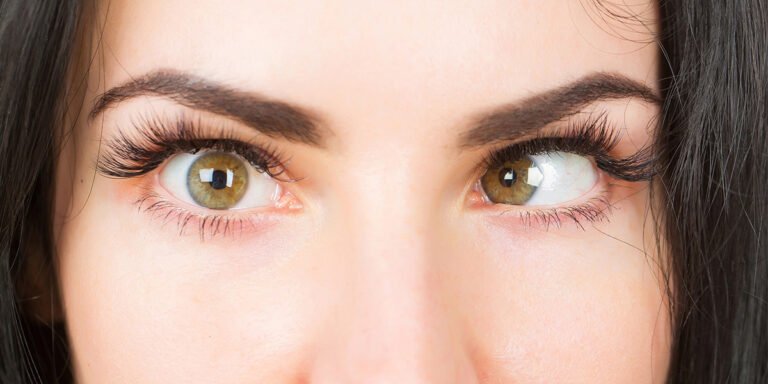 Schielkorrektur (Strabismus) bei Erwachsenen in der Türkei